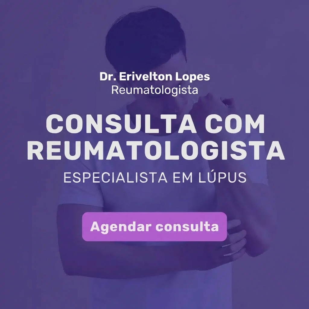 reumatologista especialista em lupus - ilustração médica por Dr. Erivelton Lopes